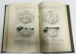 Experimentell-physiologische Untersuchungen uber die Einzelnen bei der Korperstellung in tatigkeit tretednen reflexe, uber ihr Zusammenwirken und ihre Storungen
