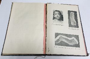Сифилис и венерические болезни.