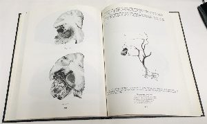 Атлас нейрохирургической анатомии.